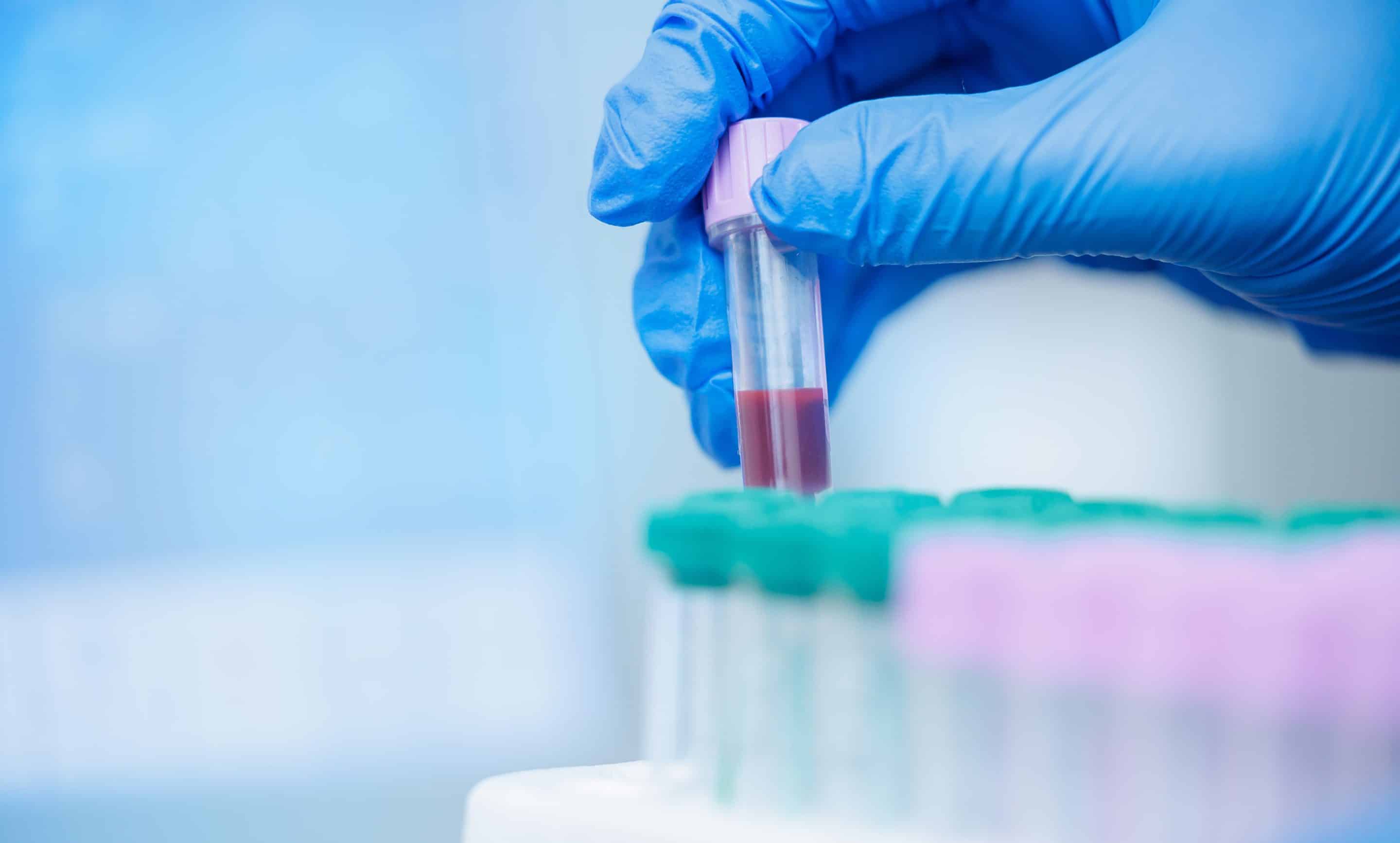 Vet bloodwork test in Meridianville, AL