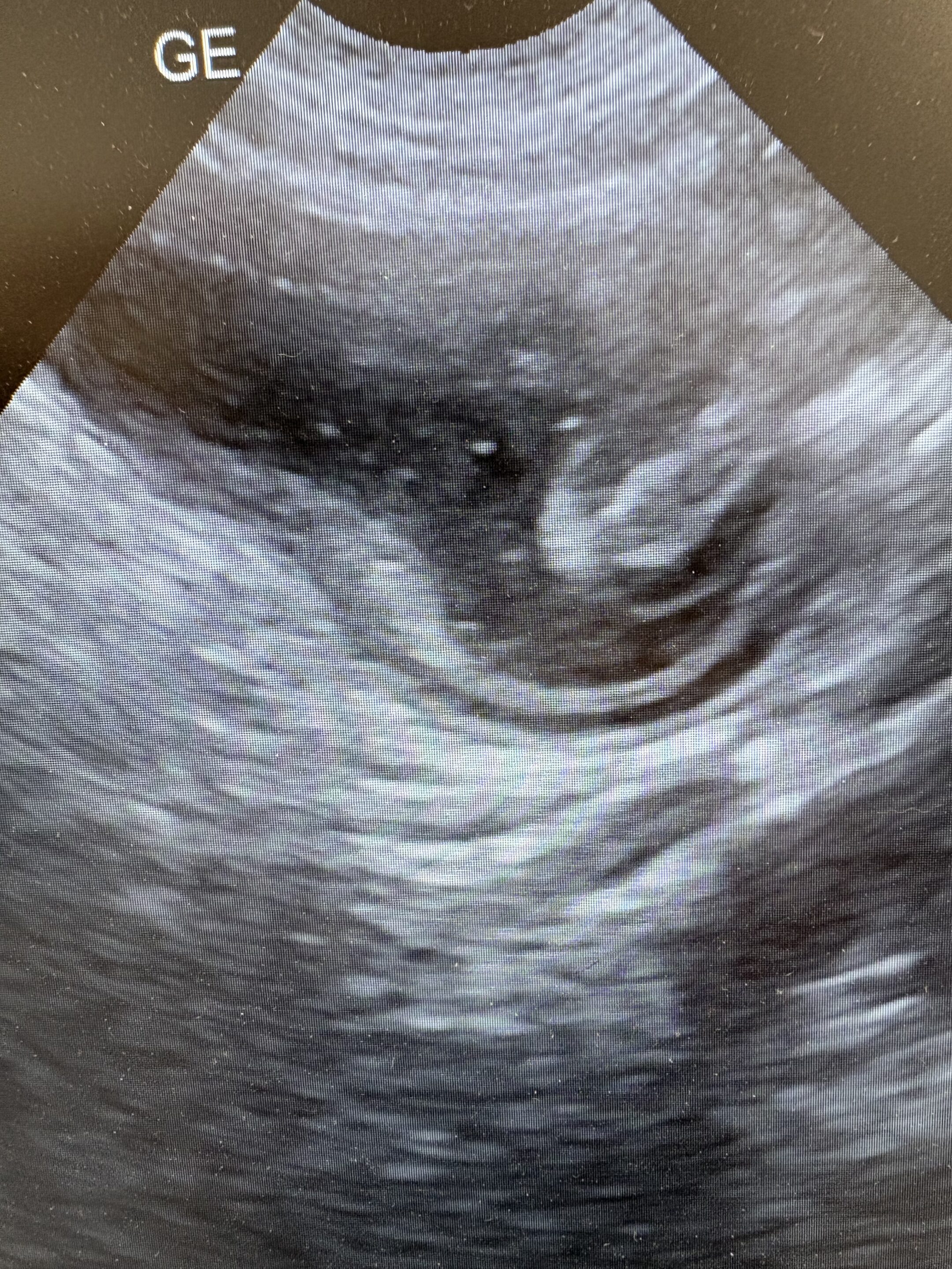 Veterinary Ultrasound care in Meridianville, AL